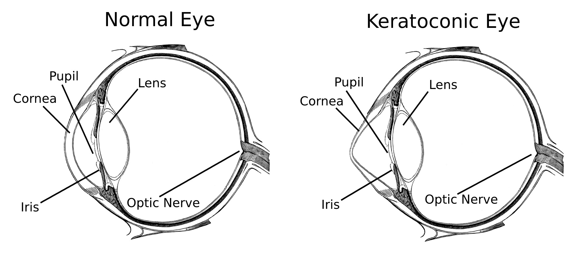 Common Eye Conditions in New Zealand We Fix Eyes